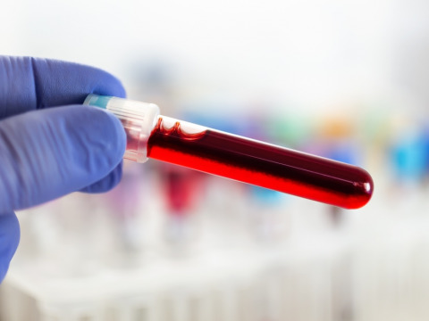 Saleh is in desperate need to undergo lab testing to determine if he is afflicted with Familial Mediterranean Fever