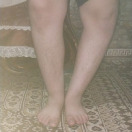 Mohammad, 15, has a deformity in his left leg that hinders his mobility, forcing him to discontinue his studies
