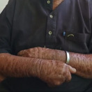 مرض السمكية لم يمنع إبراهيم من العمل وتربية أبنائه وتعليمهم رغم الألم ونظرات المجتمع