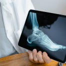 A surgery on Basma’s foot will allow her to work and study better - as she is the only breadwinner in the family