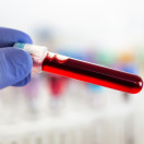 Saleh is in desperate need to undergo lab testing to determine if he is afflicted with Familial Mediterranean Fever