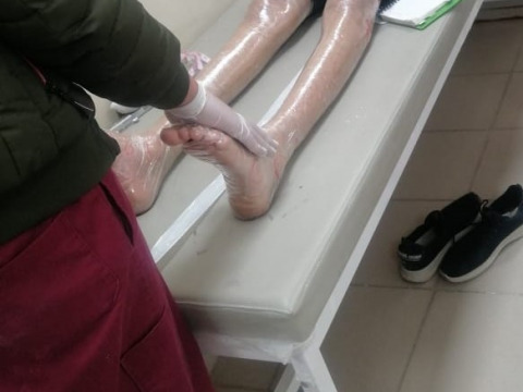 إجراء عملية تثبيت القدمين والكاحل ضرورية لتغيير حياة علي و عودته للمشي بشكل طبيعي